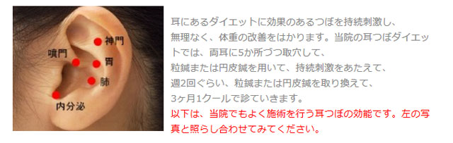 耳つぼダイエット